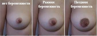 изменение цвета и размеров сосков при беременности