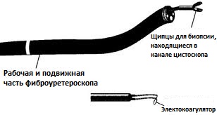 уретероскоп