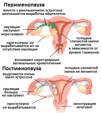 перименопауза и постменопауза