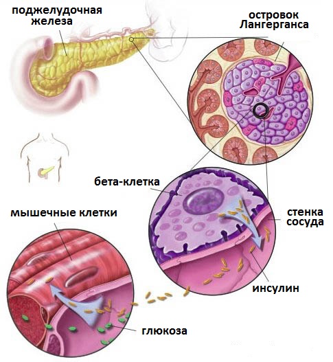 причина сахарного диабета