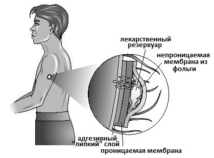 механизм действия никотинового пластыря