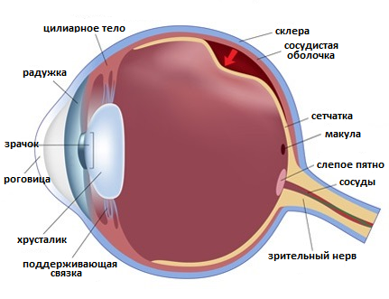 отслоение сетчатки глаза