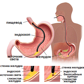 чреспищеводная эхокардиография