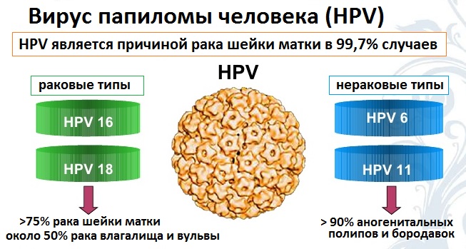 вирус папилломы человека и рак шейки матки