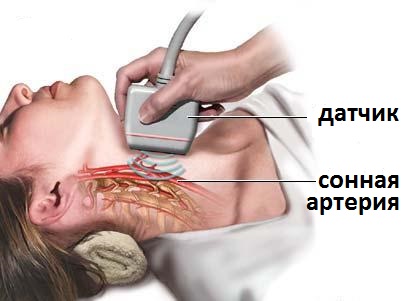 узи сосудов шеи и головы