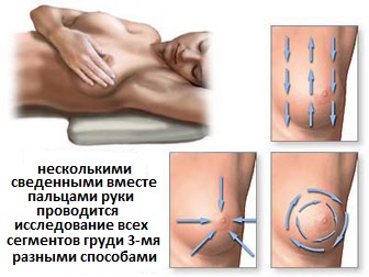 самообследование молочных желез