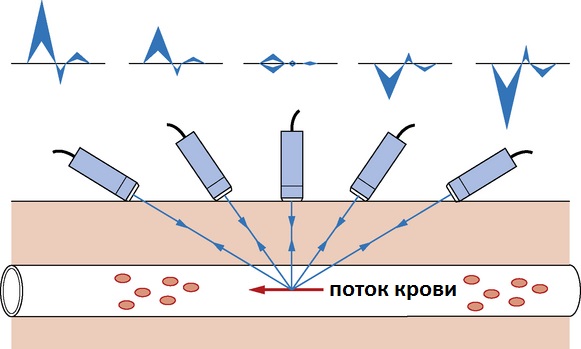 эффект допплера