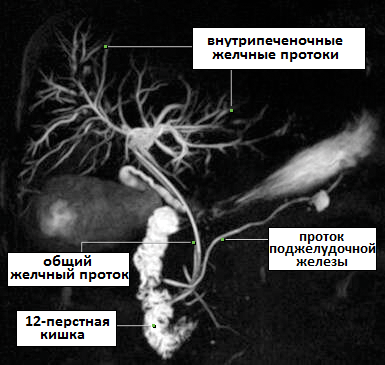 мр-холангиография