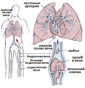тэла