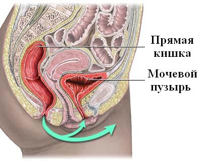 пути распространения мочевой инфекции