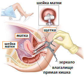 мазок папаниколау