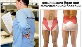 боли в пояснице при мкб