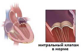 митральный клапан
