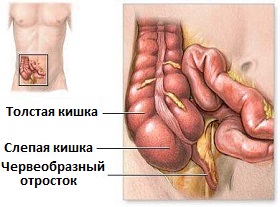 аппендикс или червеобразный отросток